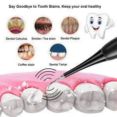 New Year's Sale Best gift for family and friends - Electric tooth cleaning instrument